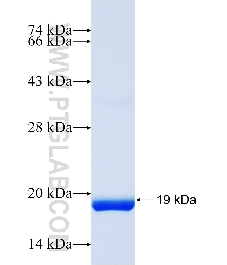 G2E3 fusion protein Ag40491 SDS-PAGE