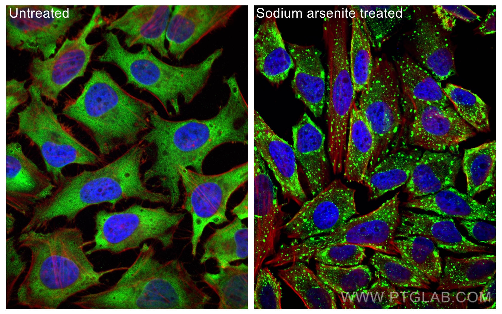 Immunofluorescence (IF) / fluorescent staining of HeLa cells using G3BP1 Monoclonal antibody (66486-1-Ig)