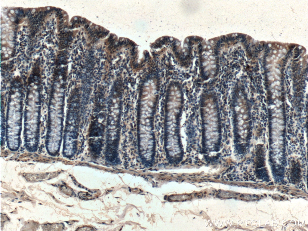 Immunohistochemistry (IHC) staining of human colon tissue using G3BP1 Monoclonal antibody (66486-1-Ig)