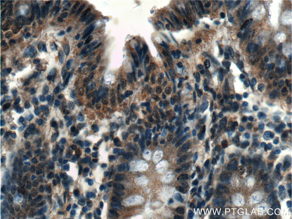 Immunohistochemistry (IHC) staining of human colon tissue using G3BP1 Monoclonal antibody (66486-1-Ig)