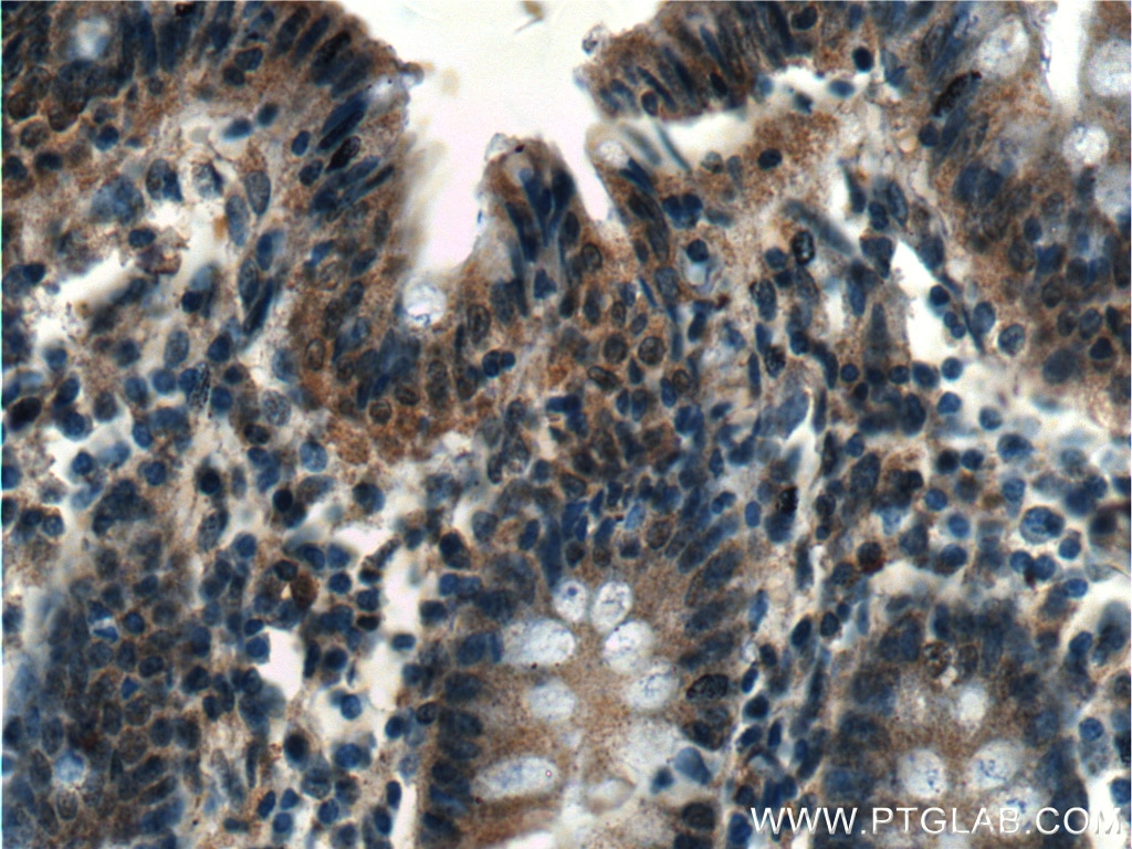 IHC staining of human colon using 66486-1-Ig