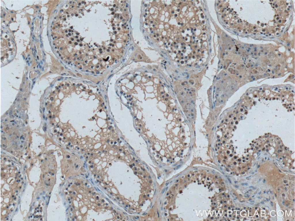 Immunohistochemistry (IHC) staining of human testis tissue using G3BP1 Monoclonal antibody (66486-1-Ig)