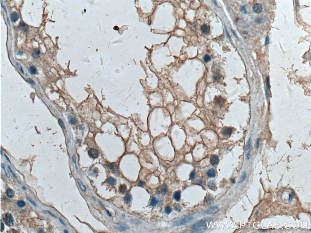 Immunohistochemistry (IHC) staining of human testis tissue using G3BP1 Monoclonal antibody (66486-1-Ig)