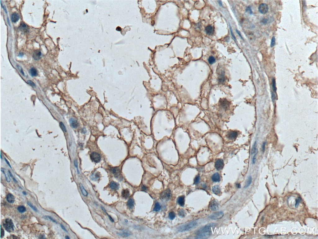 IHC staining of human testis using 66486-1-Ig