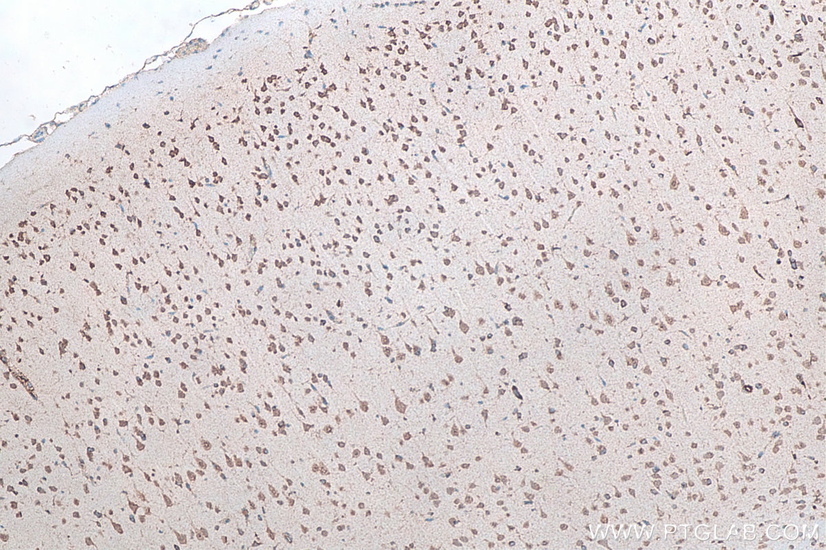 Immunohistochemistry (IHC) staining of rat brain tissue using G3BP1 Monoclonal antibody (66486-1-Ig)