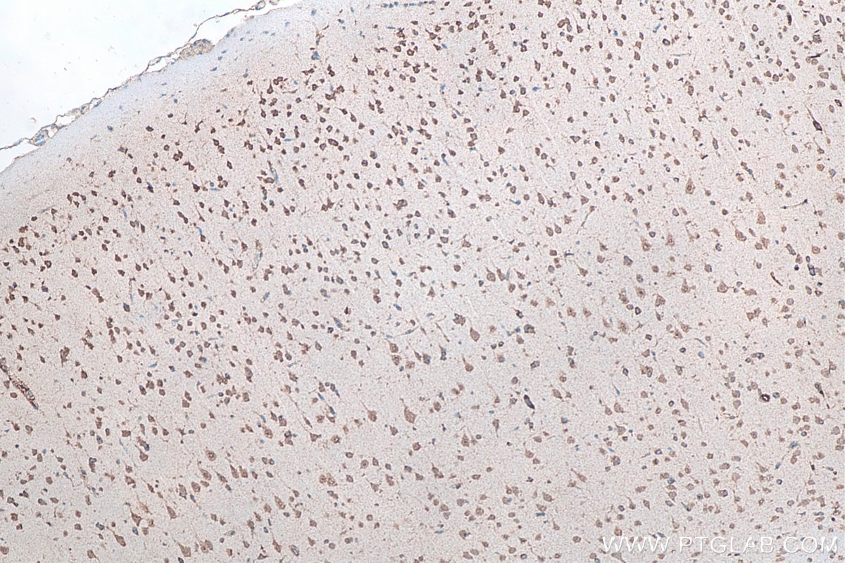 IHC staining of rat brain using 66486-1-Ig