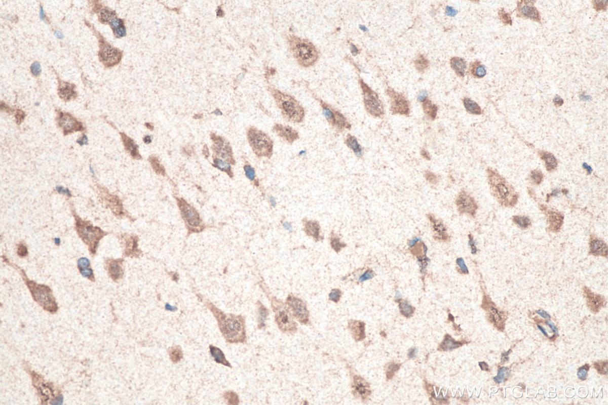 IHC staining of rat brain using 66486-1-Ig