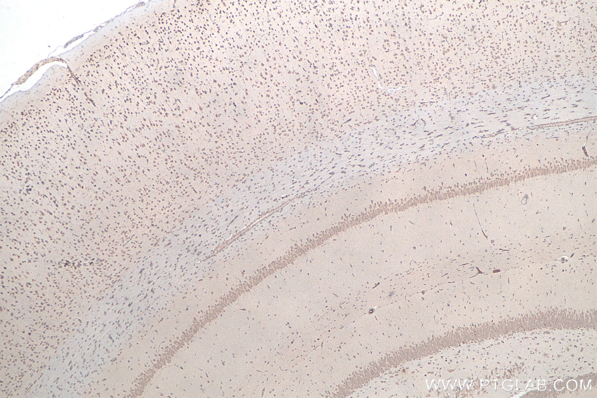 IHC staining of rat brain using 66486-1-Ig Immunohistochemistry (IHC) staining of rat brain tissue using G3BP1 Monoclonal antibody (66486-1-Ig)