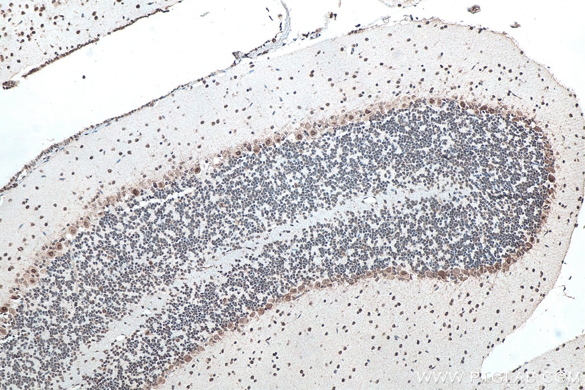 IHC staining of mouse cerebellum using 66486-1-Ig Immunohistochemistry (IHC) staining of mouse cerebellum tissue using G3BP1 Monoclonal antibody (66486-1-Ig)