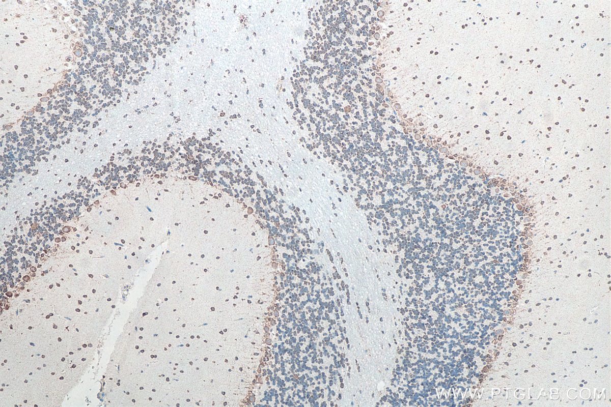 IHC staining of rat cerebellum using 66486-1-Ig Immunohistochemistry (IHC) staining of rat cerebellum tissue using G3BP1 Monoclonal antibody (66486-1-Ig)