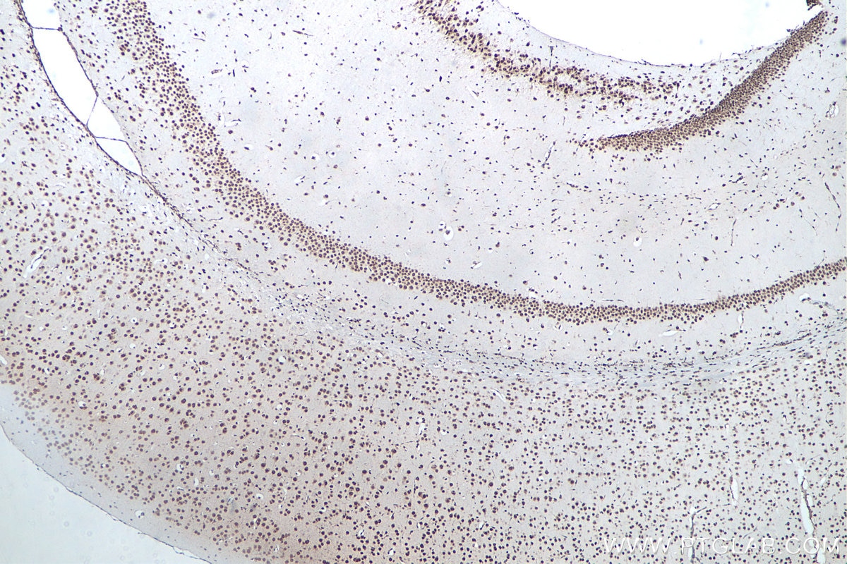 IHC staining of mouse brain using 66486-1-Ig Immunohistochemistry (IHC) staining of mouse brain tissue using G3BP1 Monoclonal antibody (66486-1-Ig)