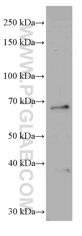 Western Blot (WB) analysis of mouse brain tissue using G3BP1 Monoclonal antibody (66486-1-Ig)