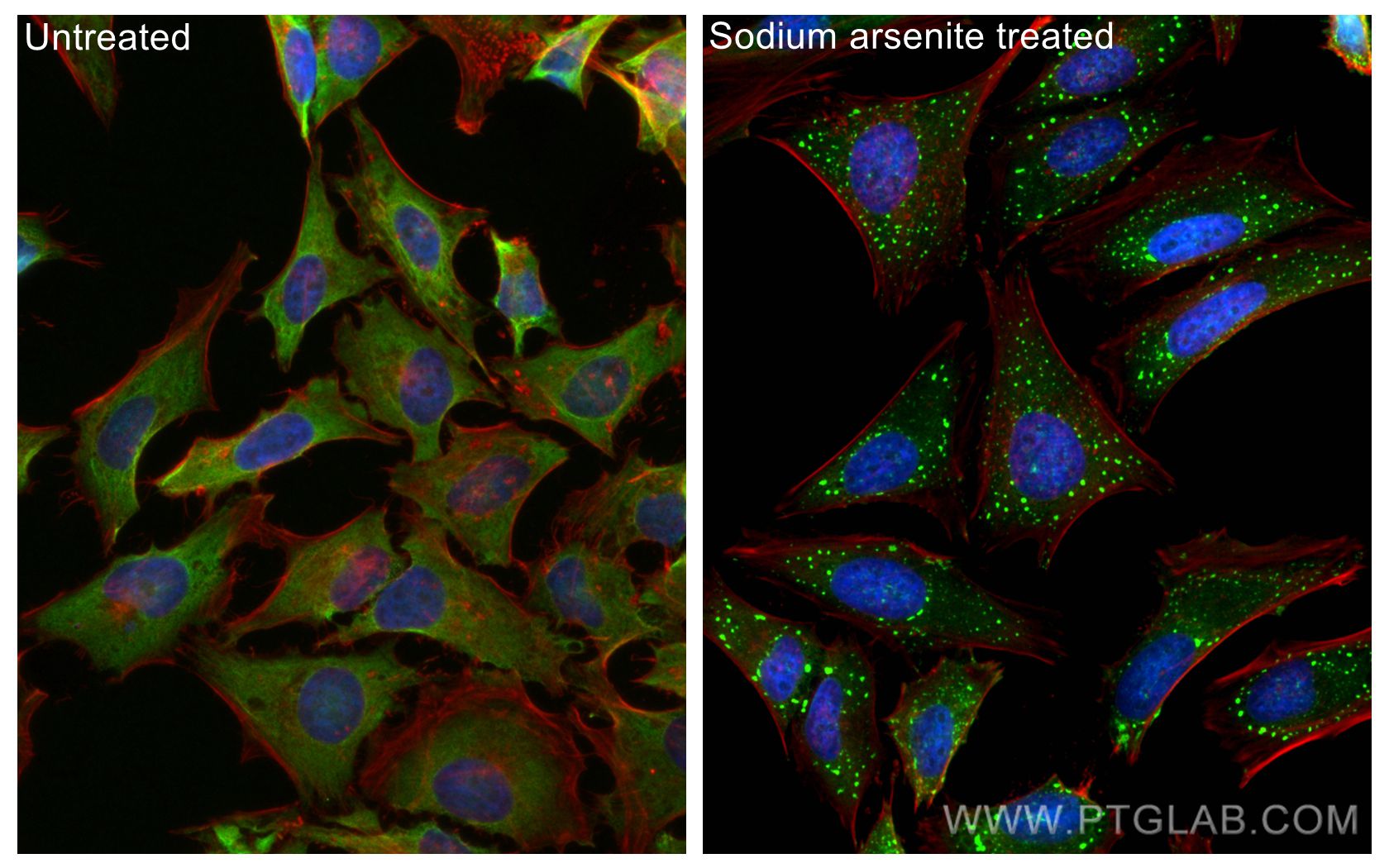 Immunofluorescence (IF) / fluorescent staining of HeLa cells using G3BP1 Polyclonal antibody (13057-2-AP)