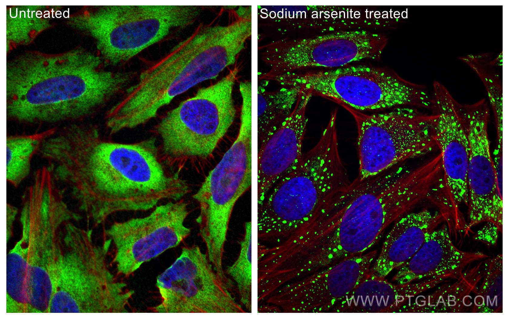 Immunofluorescence (IF) / fluorescent staining of HeLa cells using G3BP1 Polyclonal antibody (13057-2-AP)