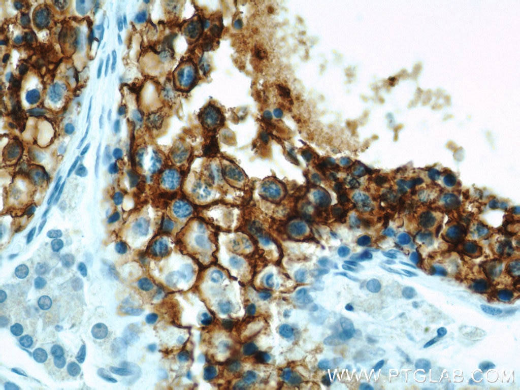 G3BP1 Polyclonal antibody