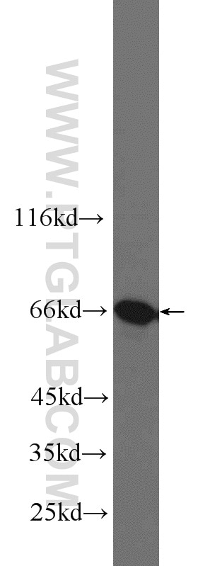Western Blot (WB) analysis of HeLa cells using G3BP1 Polyclonal antibody (13057-2-AP)