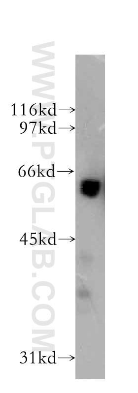 Western Blot (WB) analysis of human brain tissue using G3BP1 Polyclonal antibody (13057-2-AP)