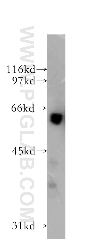 WB analysis of human brain using 13057-2-AP