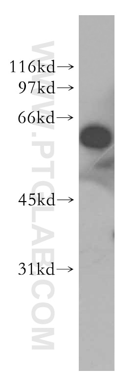 Western Blot (WB) analysis of HepG2 cells using G3BP1 Polyclonal antibody (13057-2-AP)