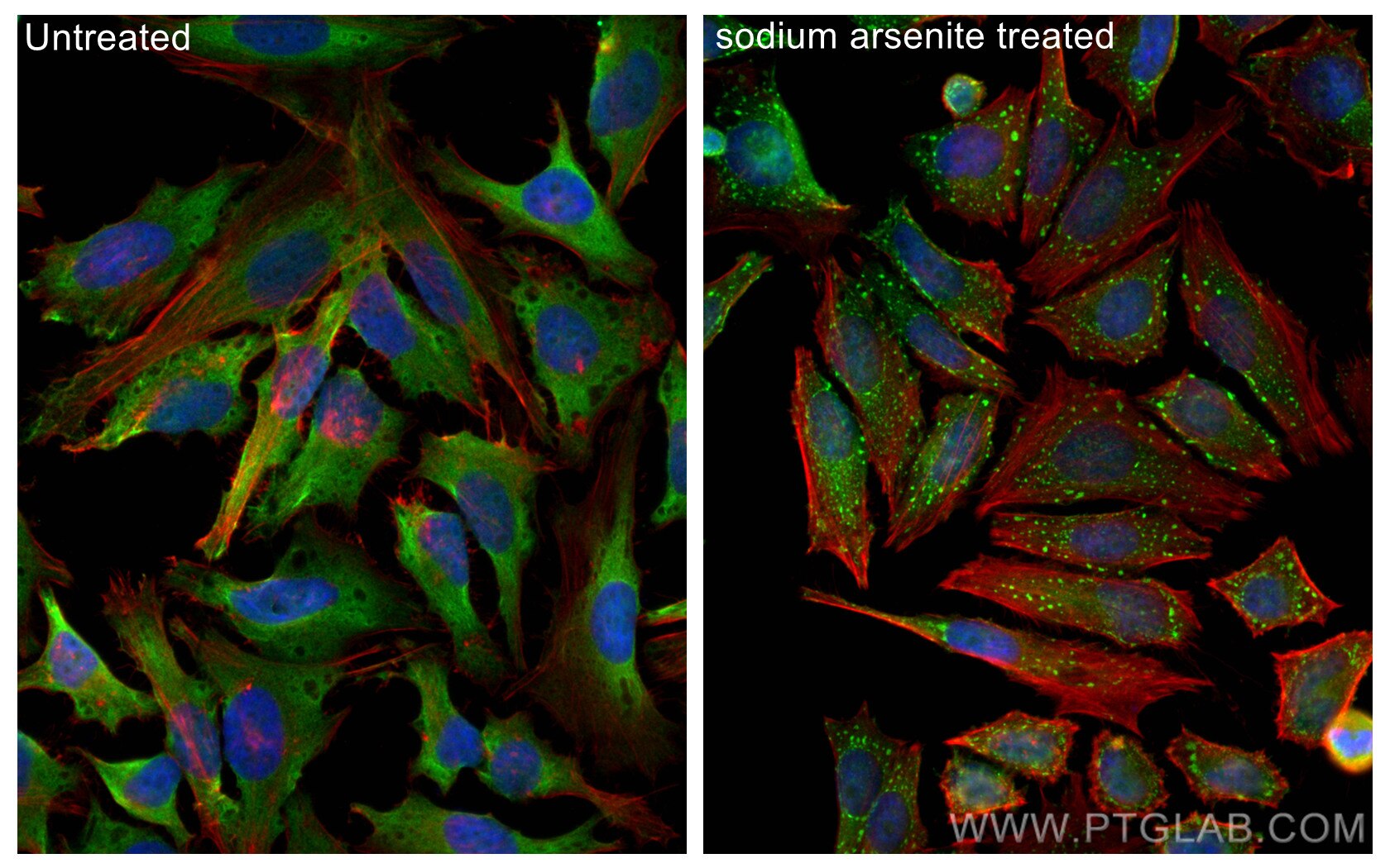 IF Staining of HeLa using 80777-1-RR