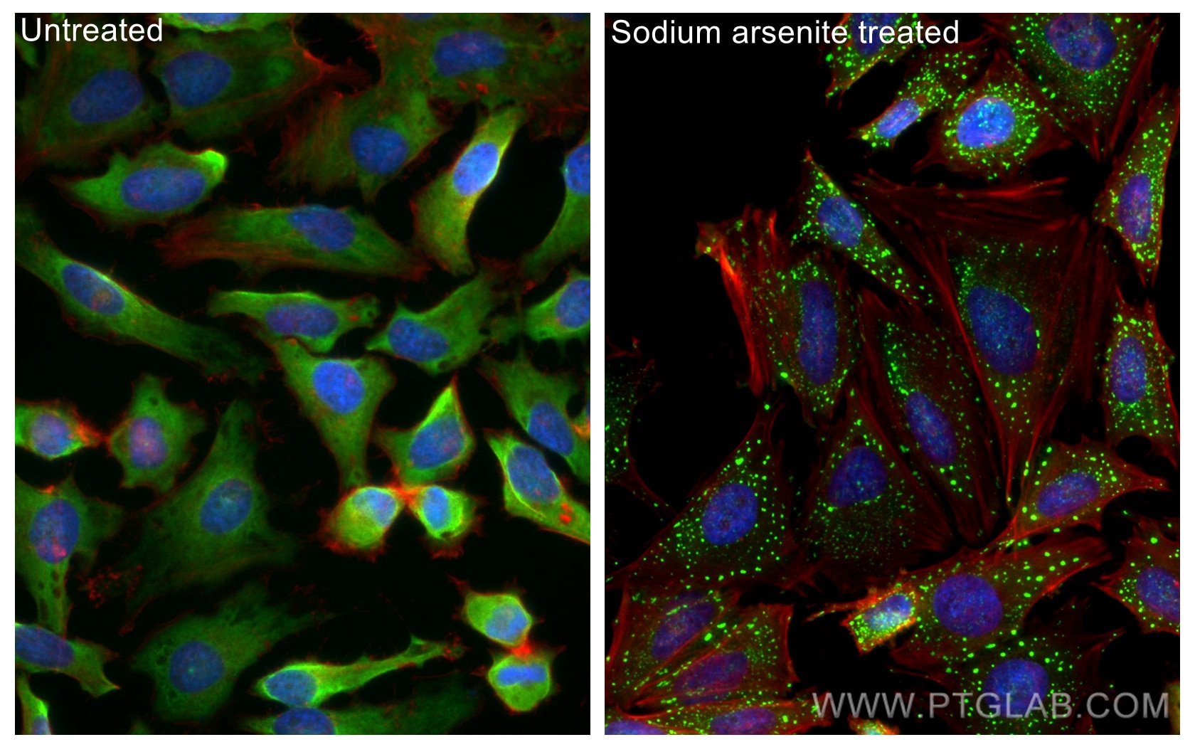 Immunofluorescence (IF) / fluorescent staining of HeLa cells using CoraLite® Plus 488-conjugated G3BP1 Polyclonal ant (CL488-13057)