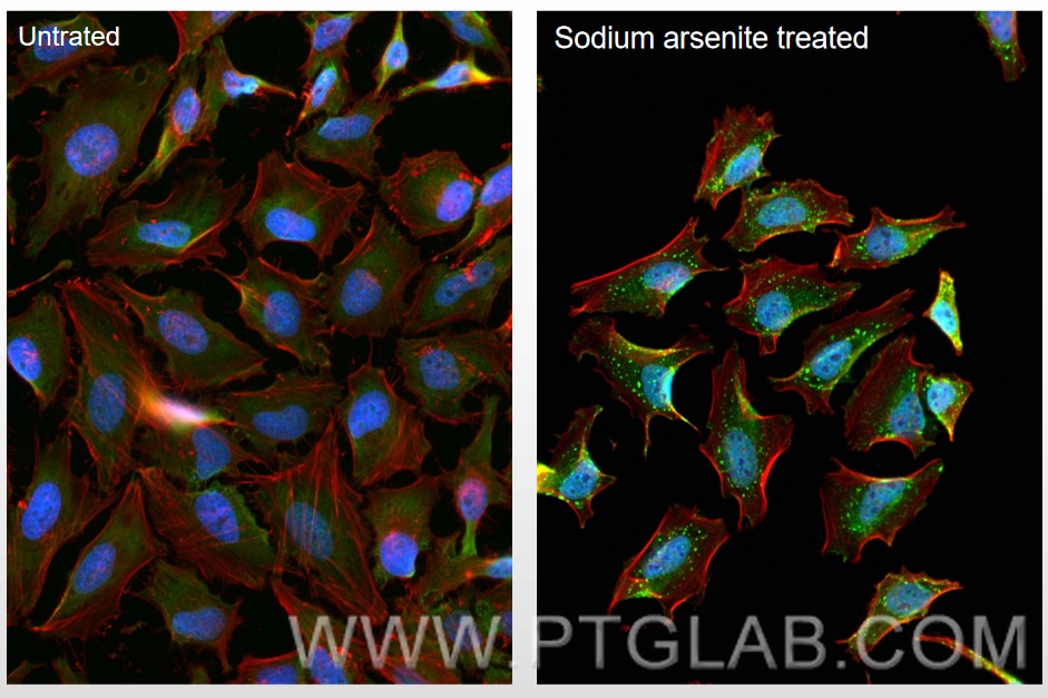 Immunofluorescence (IF) / fluorescent staining of HeLa cells using CoraLite® Plus 488-conjugated G3BP1 Monoclonal ant (CL488-66486)