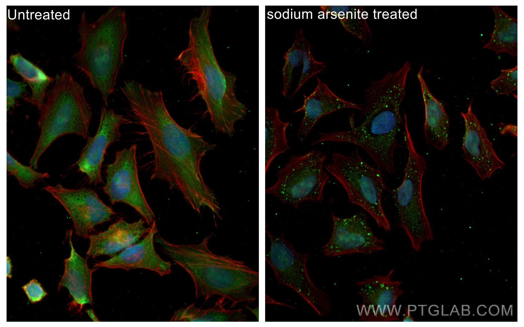 Immunofluorescence (IF) / fluorescent staining of HeLa cells using CoraLite® Plus 488-conjugated G3BP1 Recombinant an (CL488-80777)