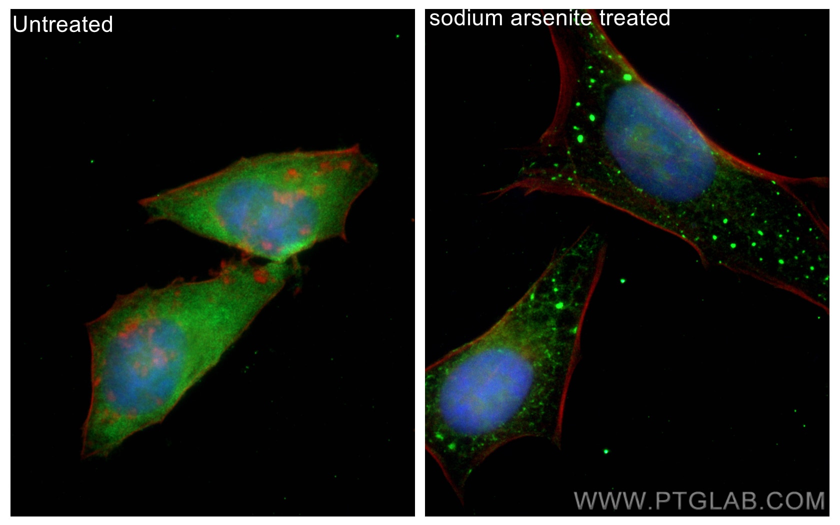 Immunofluorescence (IF) / fluorescent staining of HeLa cells using CoraLite® Plus 488-conjugated G3BP1 Recombinant an (CL488-80777)