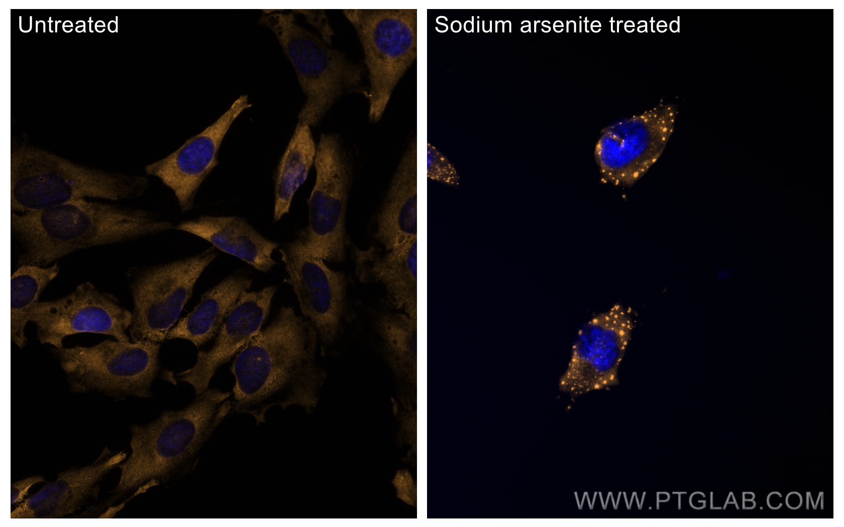 Immunofluorescence (IF) / fluorescent staining of HeLa cells using CoraLite®555-conjugated G3BP1 Polyclonal antibody (CL555-13057)