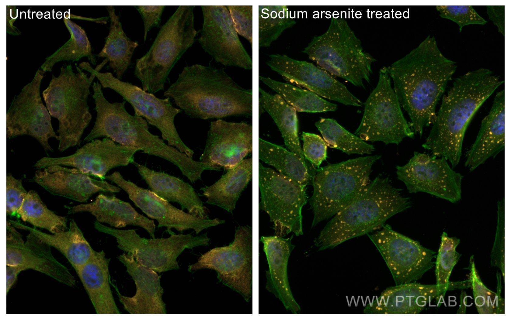 Immunofluorescence (IF) / fluorescent staining of HeLa cells using CoraLite® Plus 555-conjugated G3BP1 Monoclonal ant (CL555-66486)