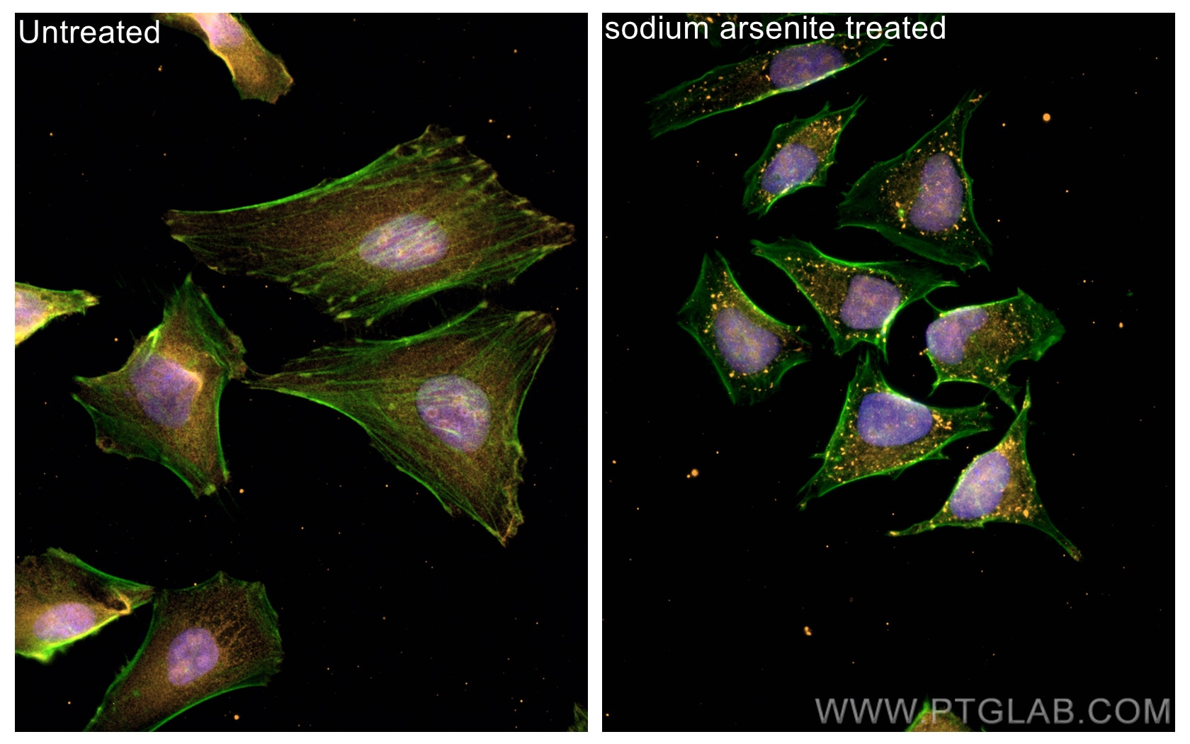 Immunofluorescence (IF) / fluorescent staining of HeLa cells using CoraLite®555-conjugated G3BP1 Recombinant antibody (CL555-80777)