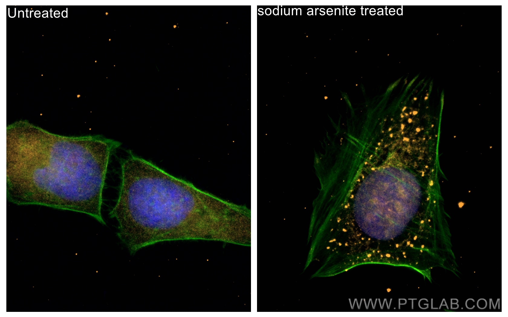 Immunofluorescence (IF) / fluorescent staining of HeLa cells using CoraLite®555-conjugated G3BP1 Recombinant antibody (CL555-80777)