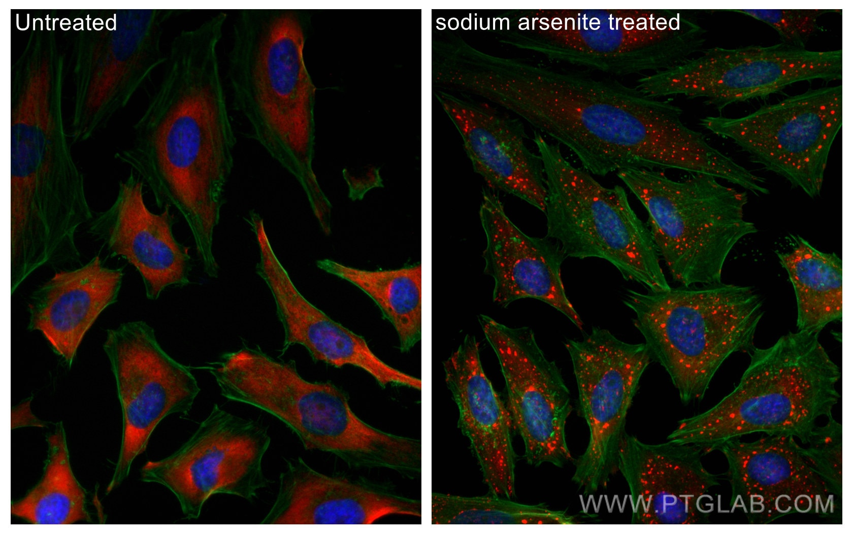 Immunofluorescence (IF) / fluorescent staining of HeLa cells using CoraLite®594-conjugated G3BP1 Polyclonal antibody (CL594-13057)