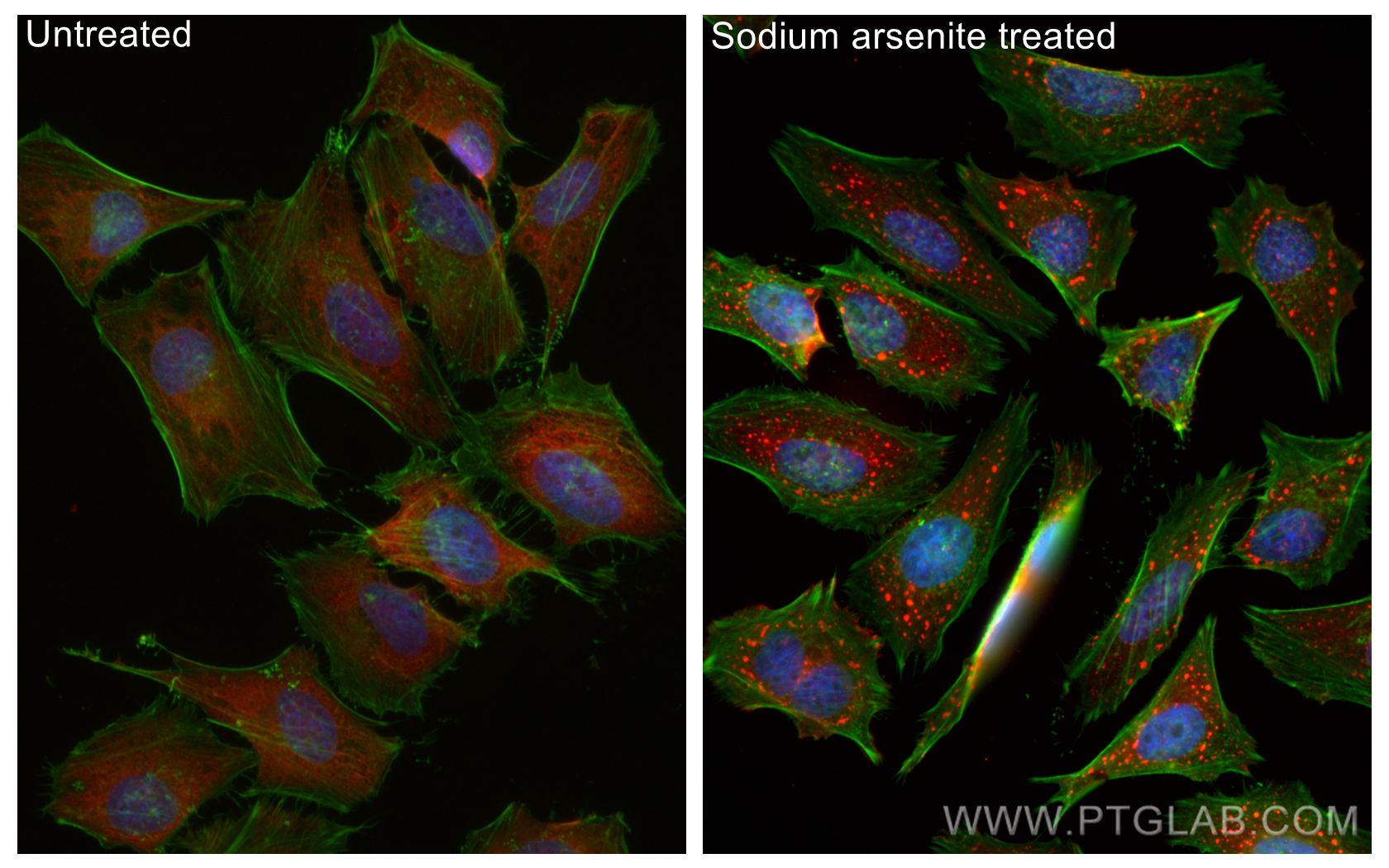 Immunofluorescence (IF) / fluorescent staining of HeLa cells using CoraLite®594-conjugated G3BP1 Monoclonal antibody (CL594-66486)