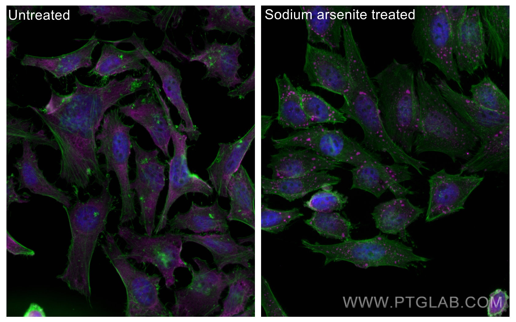 Immunofluorescence (IF) / fluorescent staining of HeLa cells using CoraLite® Plus 647-conjugated G3BP1 Monoclonal ant (CL647-66486)