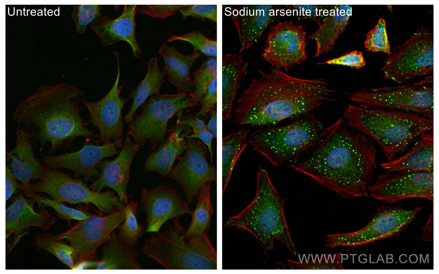 Immunofluorescence (IF) / fluorescent staining of HeLa cells using G3BP2 Polyclonal antibody (16276-1-AP)