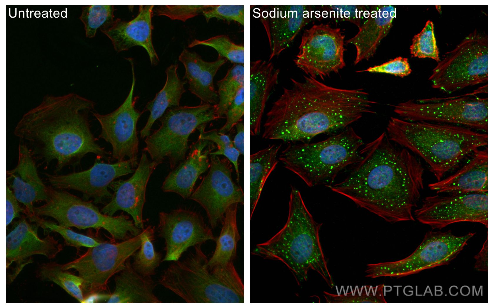 IF Staining of HeLa using 16276-1-AP