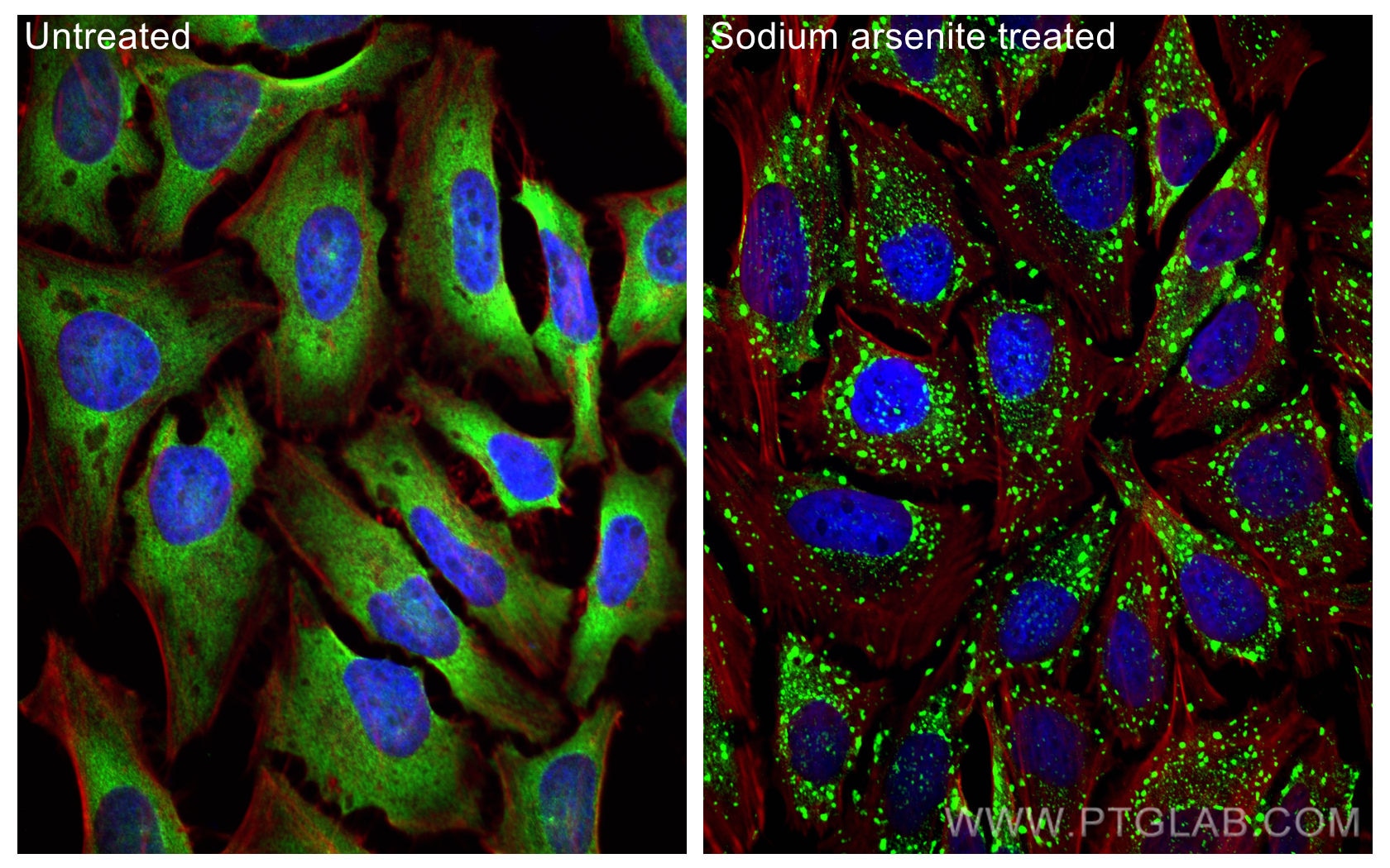 Immunofluorescence (IF) / fluorescent staining of HeLa cells using G3BP2 Polyclonal antibody (16276-1-AP)