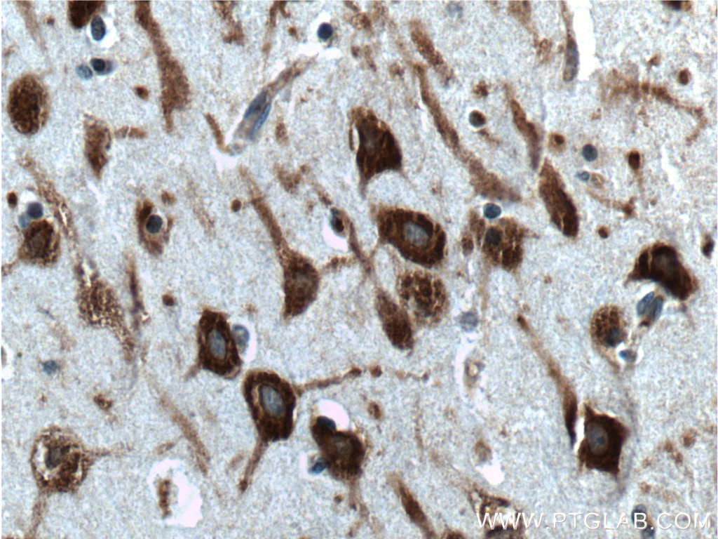 IHC staining of human brain using 16276-1-AP