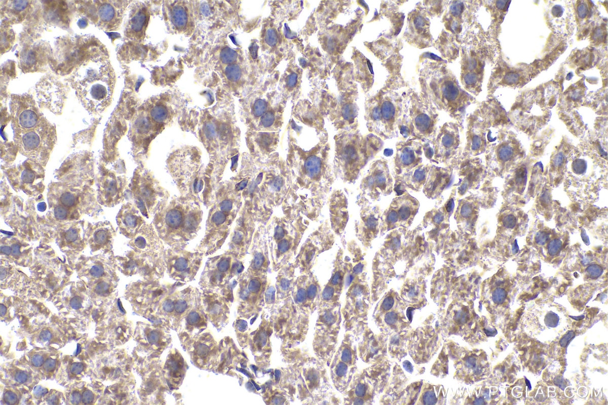 Immunohistochemistry (IHC) staining of mouse liver tissue using G3BP2 Polyclonal antibody (16276-1-AP)