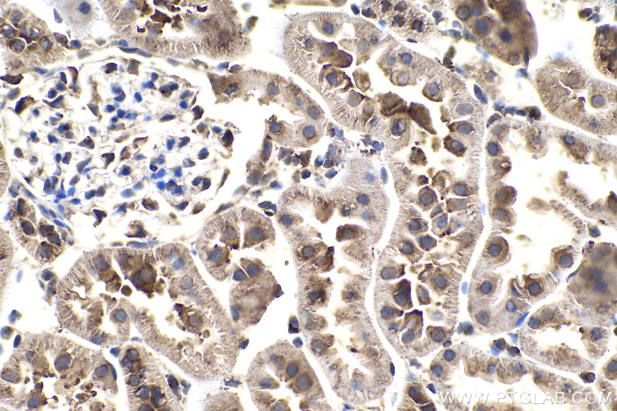 Immunohistochemistry (IHC) staining of rat kidney tissue using G3BP2 Polyclonal antibody (16276-1-AP)