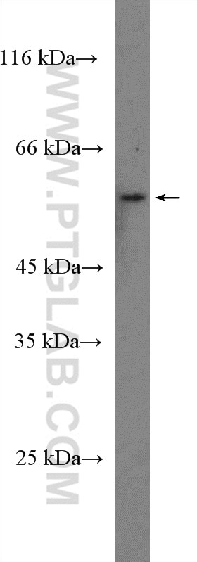Western Blot (WB) analysis of MCF-7 cells using G3BP2 Polyclonal antibody (16276-1-AP)