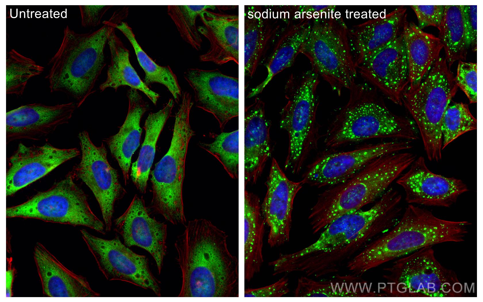 Immunofluorescence (IF) / fluorescent staining of HeLa cells using G3BP2 Monoclonal antibody (68580-1-Ig)