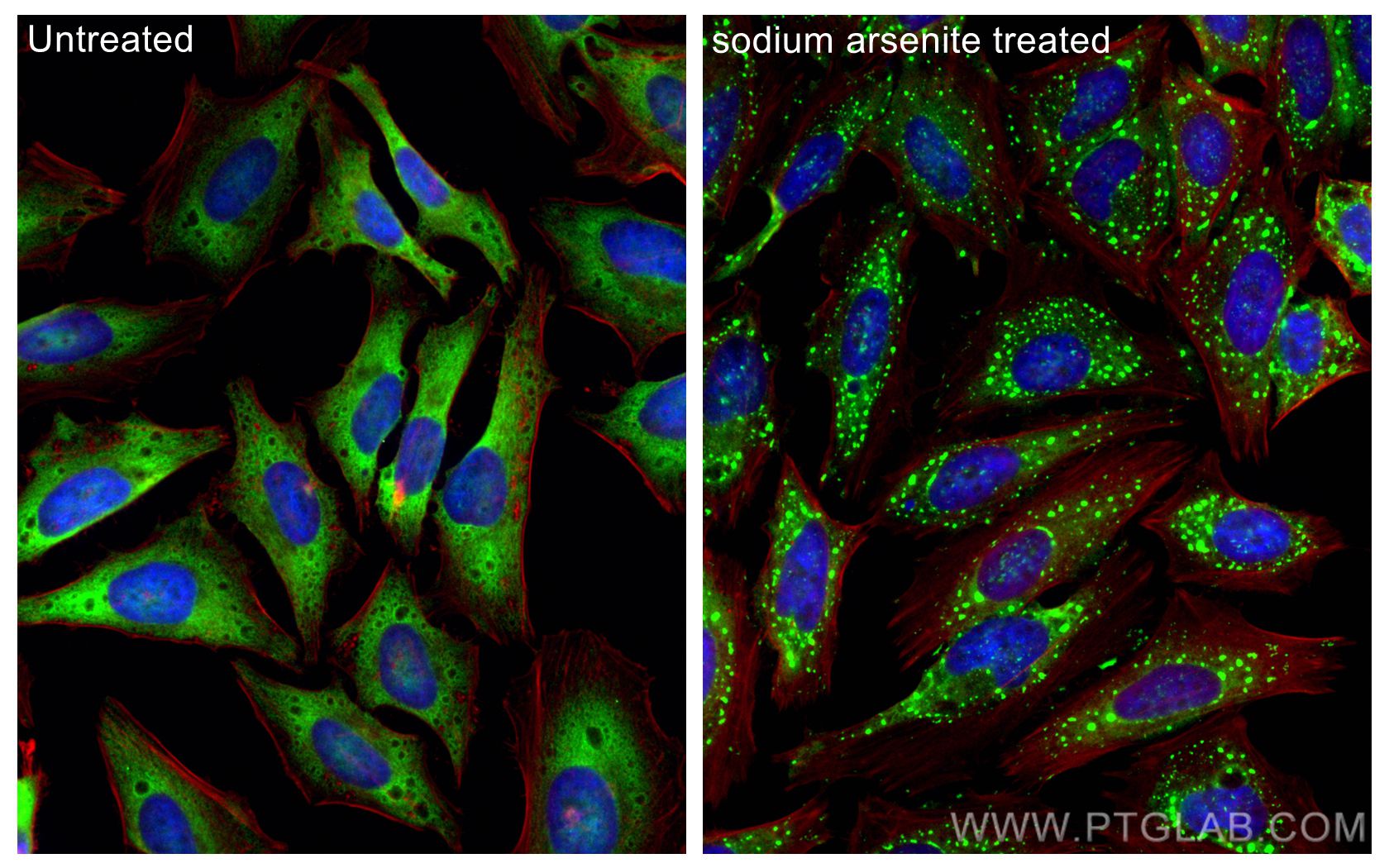 IF Staining of HeLa using 68580-1-Ig