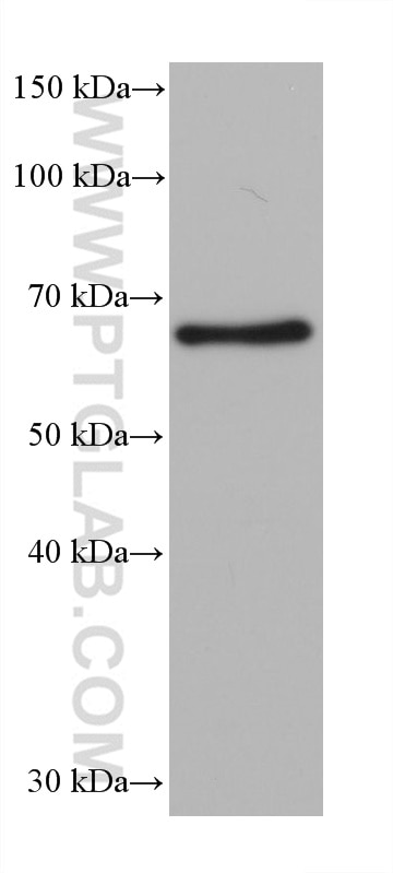 Western Blot (WB) analysis of rat brain tissue using G3BP2 Monoclonal antibody (68580-1-Ig)