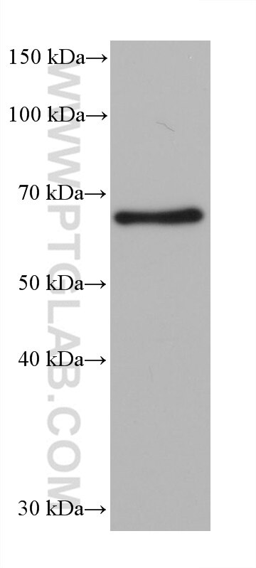 WB analysis of rat brain using 68580-1-Ig