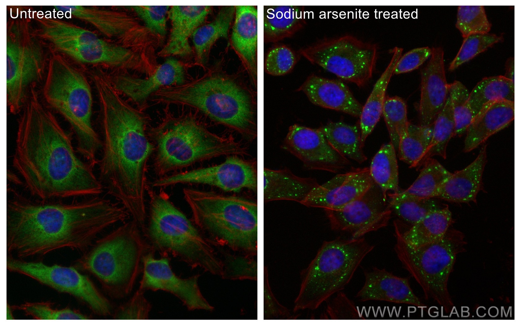 Immunofluorescence (IF) / fluorescent staining of HeLa cells using G3BP2 Recombinant antibody (82080-4-RR)