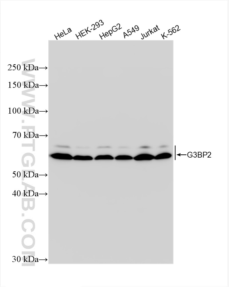 Western Blot (WB) analysis of various lysates using G3BP2 Recombinant antibody (82080-4-RR)