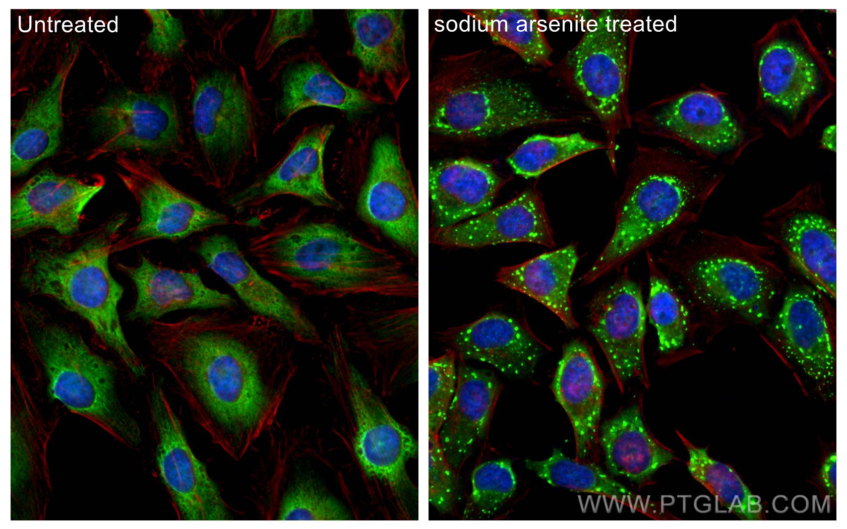 Immunofluorescence (IF) / fluorescent staining of HeLa cells using G3BP2 Recombinant antibody (82080-6-RR)