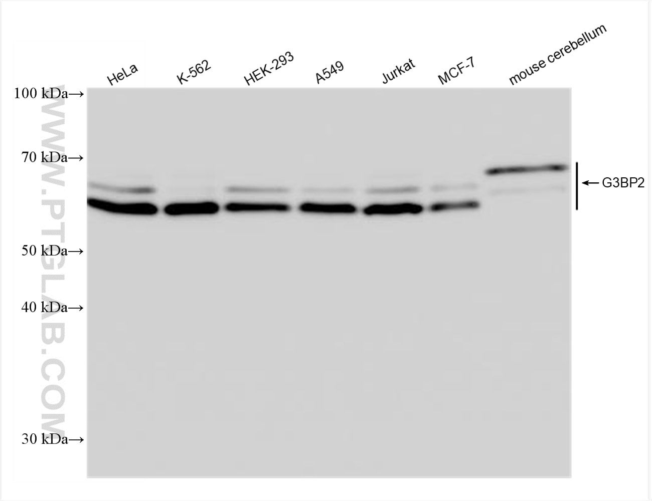 Western Blot (WB) analysis of various lysates using G3BP2 Recombinant antibody (82080-6-RR)